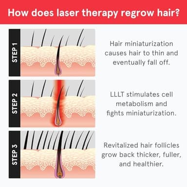 iRestore Essential - Laser Red Light Therapy for Hair Growth - FDA Cleared Hair Loss, Hair Thinning & Alopecia Treatment for Men & Women - Laser Cap for Hair Regrowth Stimulate Denser Fuller Hair - Image 8