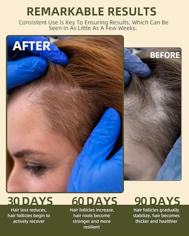 Ktintar 100% Natural Raw Batana Oil for Hair Growth, Dr Sebi Hair Growth Oil From Honduras, Thicker & Stronger Hair, Prevents Hair Loss, Eliminates Split Ends 4.23 Fl Oz (Pack of 1) - Image 3