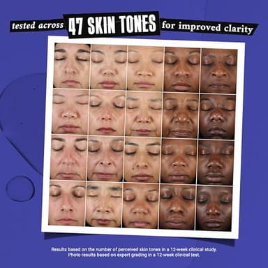 Kiehl's Clearly Corrective Dark Spot Serum, Brightening Facial Serum, Reduces Hyperpigmentation & Post-acne Marks, with Vitamin C & Salicylic Acid, All Skin Types, Paraben-free - 3.4 fl oz - Image 6