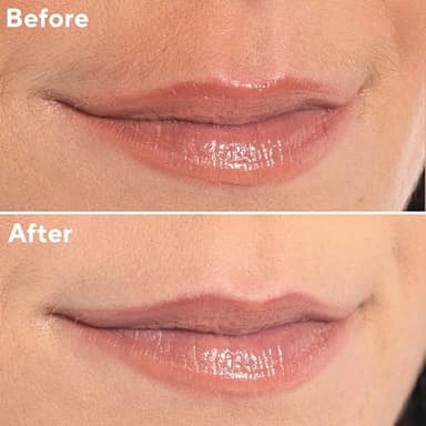 Finishing Touch Flawless Facial Hair Remover for Women, Rose Gold Electric Face Razor with LED Light, Recyclable Packaging - Image 6