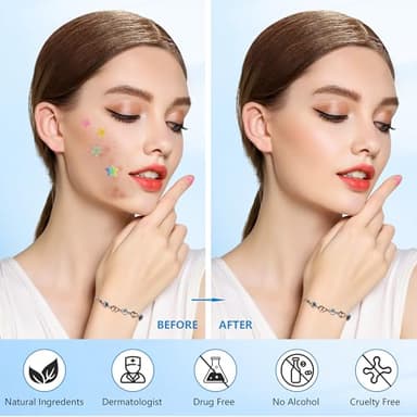 Jo Dominic Pimple stars Patches for Face, 4 Size 320 Counts Acne Patches, Hydrocolloid Patches for Covering Zits and Blemishes, Spot Stickers with Salicylic Acid, Tea Tree Oil - Image 5
