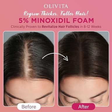 5% Minoxidil Foam for Women Hair Growth: Extra Strength Hair Regrowth Treatment – Revitalize Hair Follicles & Regrow Thicker, Fuller Hair – Hair Loss Solution-2pack - Image 5