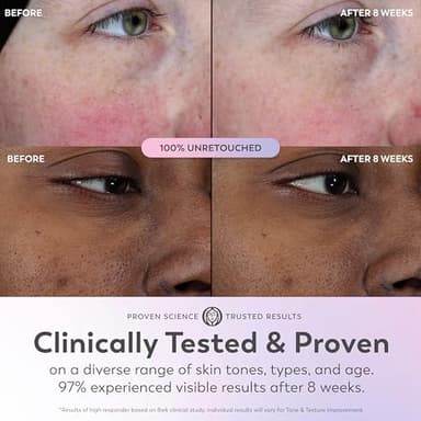 Olay Super Serum - Niacinamide, Vitamin C & E, Collagen Peptide, AHA - 5-in-1 Skin Care Benefits for Face - Healthy Glow, Brightening, Hydrating, Smoothing, Firming, Evens Tone, Anti-Aging, 1.7 Oz - Image 6