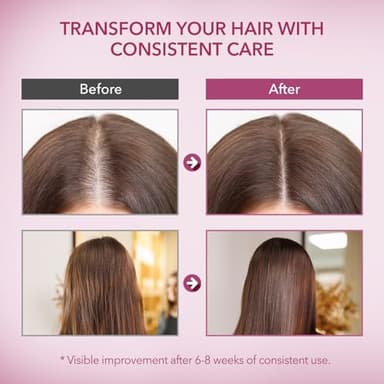 Onion & Rosemary Hair Growth Shampoo: Biotin Infused Shampoo for Hair Loss and Thinning Hair - Promotes Healthier, Thicker and Stronger Hair for Women and Men (16.9 Fl Oz (Pack of 1)) - Image 6