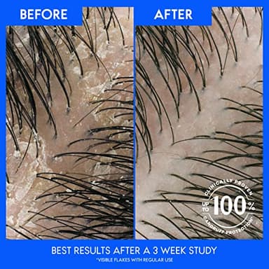 Head & Shoulders Shampoo, Daily-Use Anti-Dandruff Paraben Free Treatment, Dry Scalp Care with Almond Oil, 32.1 fl oz, Twin Pack - Image 4