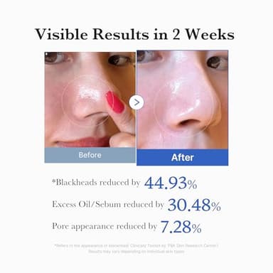 Medicube Zero Pore Pads 2.0, Dual-Textured Facial Toner Pads for Exfoliation and Pore Care with 4.5% AHA Lactic Acid & 0.45% BHA Salicylic Acid, Ideal for All Skin Types, Korean Skin Care (70 units) - Image 5