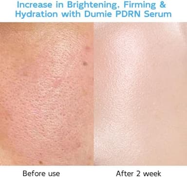 Salmon DNA PDRN Anti-Aging Serum, 5000ppm Salmon Egg DNA Ampoule, 2000ppm Collagen, Glutathione, Niacinamide & 6 Hyaluronic Acids, Korean Skincare for Wrinkles & Radiance,0.05 fl.oz x 30e - Image 5