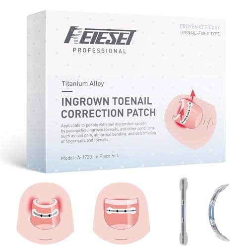 Reieset Titanium Alloy Ingrown Toenail Treatment, Nail Tools, and Ingrown Toenail Removal Kit Specially Designed for Curved Nail Repair and Ingrown Toenail Corrector (0.59/0.67in) - Image 1