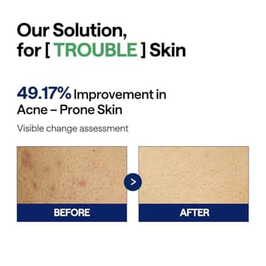 MEDIHEAL Teatree Trouble Facial Toner Pads with Tea Tree & Lactobacillus - Calming & Soothing for Sensitive & Acne Prone Skin - Vegan Face Gauze, 100 Pads - Image 4