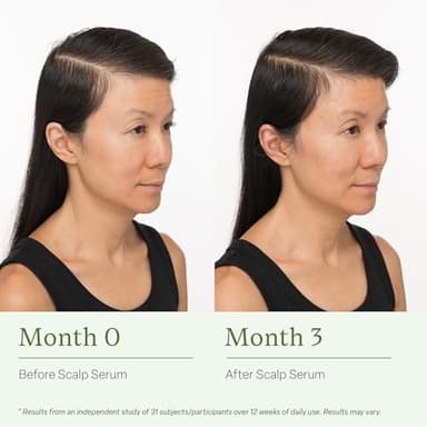 Divi Scalp Serum for Thinning Hair, 30ml – Clinically Tested, Nourishing Formula with Amino Acids, Caffeine & Rosemary Oil – Promotes Healthy Scalp & Fuller-Looking Hair, Reduces Oil & Product Buildup - Image 5