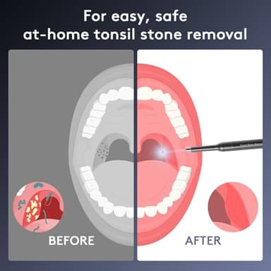 Tonsil Stone Removal Kit with Camera- 2025 Upgraded Tonsil Stone Remover Tool Connect with WIFI - Visual Led Light Tonsillolith Removal Tool with 4 Head Attachments (Black) - Image 6