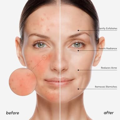 MAREE Glycolic Acid Pads - Toner Pads for Face Cleansing - Exfoliating Pad with Tea Tree Oil, Salicylic Acid & Vitamins E, B3, B5 - Acne Clearing, Skin Pore Resurfacing & Radiance Device - 50 Count - Image 5