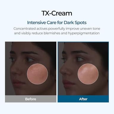 DR.Melaxin TX Tranexamic Acid CREAM | Skin freckle Cream, Blemishes, Anti-pigmetation korean skin care | Korean Cosmetics | 1.7 fl oz (50 ml) - Image 2
