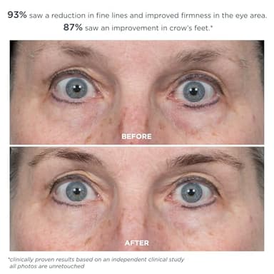m-61 ProSmooth Retinol Eye Serum | 0.1% Non-Irritating Retinol Eye Serum with Vitamin C, 0.5 Fl Oz - Image 4