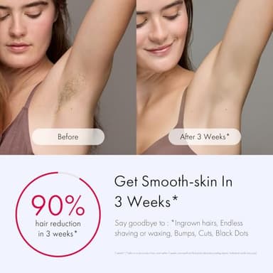 Ulike Laser Hair Removal for Women and Men, Air 3 Ice-Cooling IPL Hair Removal Device for Nearly Painless & Long-Lasting Results, 3 Modes & Auto Flashing for Fast Full Body Hair Removal from Home - Image 3