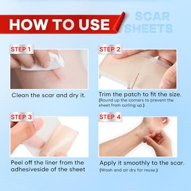 Wifamy Silicone Scar Sheets for Women: Medical Grade Scar Removal C-Section Recovery & Post-Surgery Care (1.6"X 60" Roll-1.5M) - Image 4