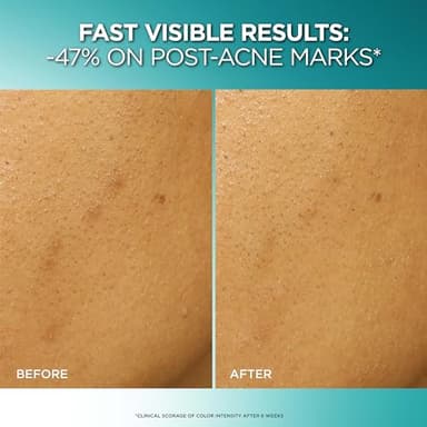 L'Oreal Paris Bright Reveal Dark Spot Exfoliant Peel, 25% AHA BHA PHA Face Exfoliator Solution, Gentle Skincare to Visibly Reduce Dark Spots and Renew Skin Texture, Includes SPF Lotion Sample - Image 4
