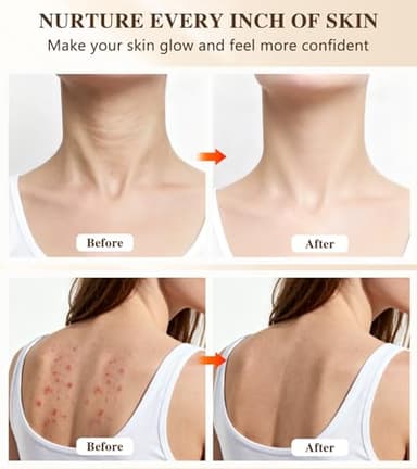 Red Light Therapy for Face and Neck, 720 LED Infrared Light Therapy Mask for Wrinkles and Acne, Large 30.8" x 11.8" Panel for Body, Red Light Mask Gift for Women, Mom, PDT Facial Skincare at Home - Image 4