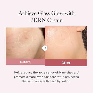 medicube Salmon DNA PDRN Pink Hyaluronic Moisturizing Cream | Blemish Relief & Hydrating Care | Restores Skin Elasticity & Glow | Korean Skincare, Even Skin Tone & Pore Care | 50ml / 1.69 fl.oz. - Image 3