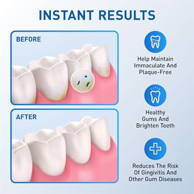 Water Flosser Replacement Tips for Waterpik, Replacement Heads for Waterpik (6 Classic Jet Tips) - Image 4