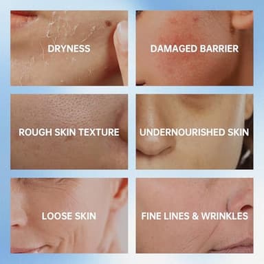 VGO Snail Mucin 92% Moisturizer Daily Face Moisturizer Hydrating Repair Face Gel Cream for Dry & Sensitive Skin, All Skin Types 50g / 1.76oz - Image 3