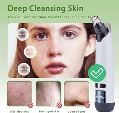 Blackhead Remover Pore Vacuum - Facial Pore Cleaner with 3 Adjustable Suction Levels, 4 Blackhead Removal Tools, Electric Acne Extractor Tool for Women & Men - Image 5