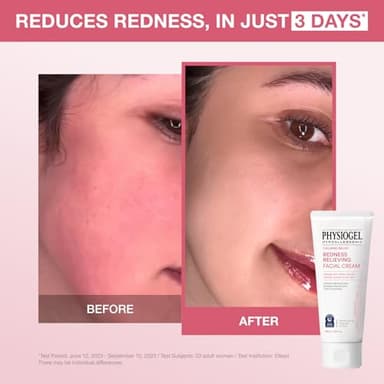 Physiogel Redness Reducing Cream – Ceramide Moisturizer for Dry, Sensitive & Redness-Prone Skin, Repairs Skin Barrier, Dermatologist-Tested, Fragrance-Free, Korean Skincare, 1.69 fl oz - Image 2