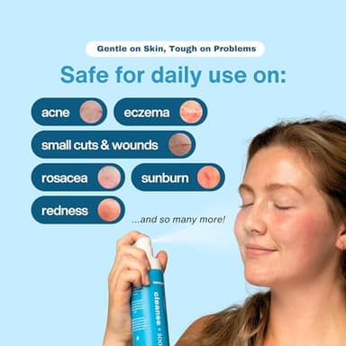 Honeydew Labs Hypochlorous Acid Spray – HOCl Face & Skin Mist for Acne, Eczema & Irritation – Multi-Purpose Skin Repair – Eyelid Cleanser, Post-Workout, Post-Procedure, Scalp & Sensitive Skin – 6.8 oz - Image 5