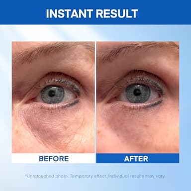 Instant Under Eye Lift Serum - Reduces Eye Bags, Wrinkles, Puffy Eyes, Dark Circles & Crow’s Feet in Minutes - Advanced Firming Polysaccharide Formula for Mature Skin - 20 mL - Image 3
