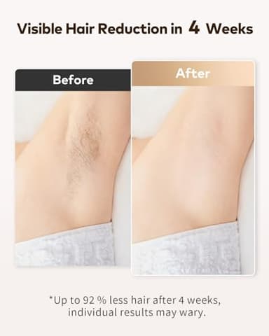 LYSMOSKI Laser Hair Removal for Women and Men, Safe at-Home Hair Removal Device, Hair Laser Removal with Long-Lasting in Hair Reduction for Armpits Back Legs Arms Face Bikini Line - Image 2