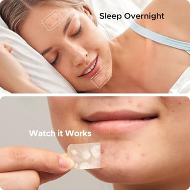 Large Pimple Patches for Face, 7 Sizes Big Acne Patches, XL Hydrocolloid Bandages for Body, Chin, Forehead, Nose, Back Blemish Zit Breakouts, Hydrocolloid Patch (Square, Strip, Dot 142 Count) - Image 4