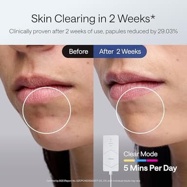 Ulike ReGlow LED Light Therapy Mask, Red Light Therapy for Face, 4 Modes with Red, Blue, Yellow & Infrared Lights for Reduce Acne & Anti-Aging, Eye-Protection, 272 Beads, Remote Control,White - Image 5