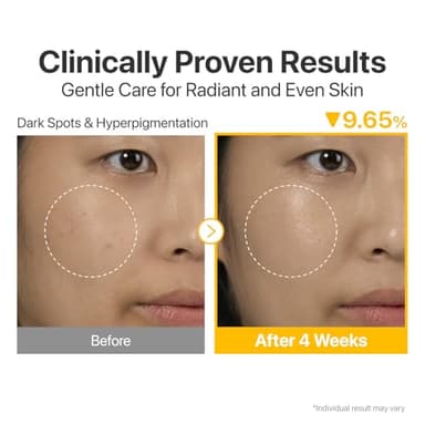 numbuzin No.5 Serum 30ml+10ml | Tranexamic Acid 4%, Niacinamide 5%, Glutathione, Vitamin C |Vitamin Concentrated Serum | Hyperpigmentation| Suitable for Sensitive Skin, Korean Skincare | 1.01 fl. oz. - Image 4