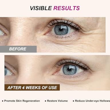 Abading Calcium Volume Multi Balm,Intensive Repair & Moisturizing Cream,Hydrating,Firming Skin,Suitable for Eyes,Neck,Face,0.32 oz/9 g (Pack of 1) - Image 4
