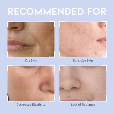 #OOTD Collagen Hydrating Sheet Masks for Face Korean Anti Aging Mask Sheet for Dry Skin & Sensitive Skin, EVE Vegan, Not Tested on Animals, No Parabens, No Sulfates, Hyaluronic Acid, Witch Hazel 10EA - Image 6