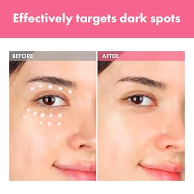 TOSOWOONG Arbutin 7% Intensive Spot Cream with 70,000ppm Arbutin, 3% Tranexamic Acid, 1% Niacinamide, Glutathione, Dark Spots, freckle, Blemishes, Anti-pigmentation, Korean Skin Care, 20ml, 0.67 fl.oz - Image 3
