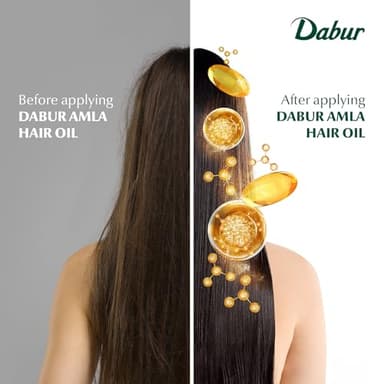 Dabur Amla Hair Oil - Nourishing Indian Oil for Men & Women, for Healthy, Moisturized Hair and Scalp (300ml) - Image 6