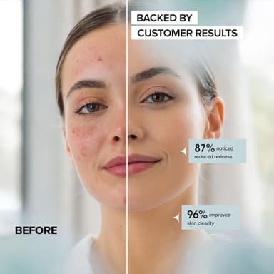 Face Towels - Ultra Soft and Thick Disposable Face Towelettes for Women - Biodegradable Facial Towels for Sensitive Skin - Face Cleansing, Makeup Removal, 10x12 Extra Large - 50 Pack - Image 2