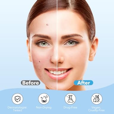 Pimple Patches for Face, Hydrocolloid Acne Patches, Cute Round Shape Zit Covers, Spot Stickers with Tea Tree, Salicylic Acid & Cica Oil| 2 Sizes (9mm, 12mm) |288 Count - Image 4