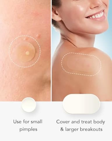 LitBear Large Acne Pimple Patches, 5 Sizes 80 Patches for Large Breakouts, Acne Patches for Face, Chin or Body, Acne Spot Patch with Tea Tree & Calendula Oil, Hydrocolloid Bandages for Acne Skin - Image 7