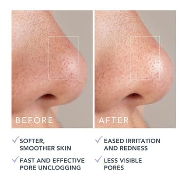 FOREO KIWI Active Pore & Blackhead Mask, 3.5 oz - Blackhead Remover - Clay Mask & moisturizing Jojoba Oil - Pore Minimizer - Skin Purifying & Detox Face Mask - Vegan & Cruelty-free - All Skin Types - Image 6