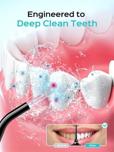 COSLUS Portable Water Flosser for Teeth: 10 Pressure Settings Professional Water Dental Pick for Orthodontic, Braces & Sensitive Gums - Cordless for Travel Use, for Adults Teens, BPA-Free, E40 - Image 2