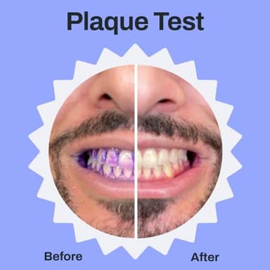 autobrush U Shaped Electric Toothbrush, ADA Accepted, Sonic Pro with Unique 360° Nylon Bristles, 3 Cleaning Modes, Ultrasonic, LED Lights, Rechargeable, Waterproof (Women's Small, White) - Image 8