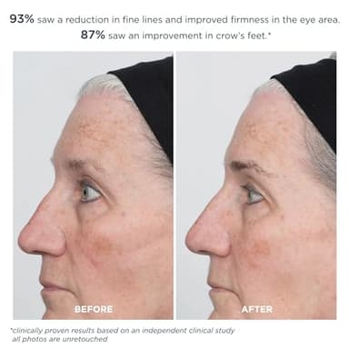 m-61 ProSmooth Retinol Eye Serum | 0.1% Non-Irritating Retinol Eye Serum with Vitamin C, 0.5 Fl Oz - Image 5