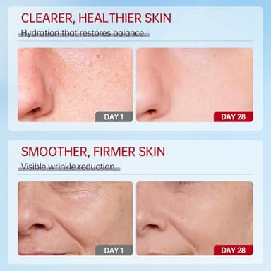 VGO Snail Mucin 92% Moisturizer Daily Face Moisturizer Hydrating Repair Face Gel Cream for Dry & Sensitive Skin, All Skin Types 50g / 1.76oz - Image 5