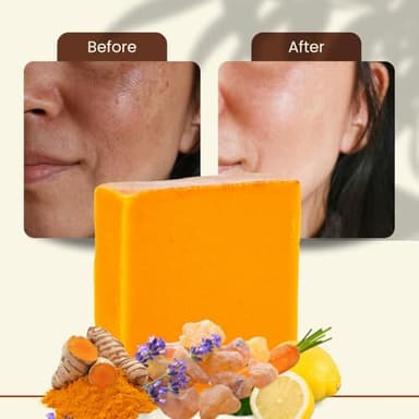 Turmeric Skin Cleansing Soap - Natural Glow Face & Body Cleanser for Acne, Dark Spots & Scars, Gentle for All Skin Types (4.5 oz) 1 bar - Image 9