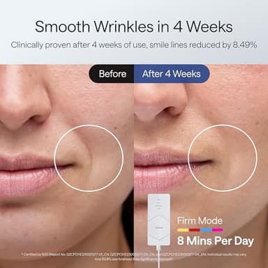 Ulike ReGlow LED Light Therapy Mask, Red Light Therapy for Face, 4 Modes with Red, Blue, Yellow & Infrared Lights for Reduce Acne & Anti-Aging, Eye-Protection, 272 Beads, Remote Control,White - Image 6