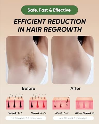 XSOUL At-Home IPL Hair Removal for Women and Men Permanent Hair Removal 999,999 Flashes Painless Hair Remover on Armpits Back Legs Arms Face Bikini Line, Corded - Image 5