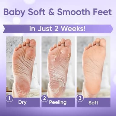 Foot Peel Mask - Foot Mask for Baby Soft Skin - Remove Dead Skin, Dry, Cracked Feet & Callus, Foot Spa, Made with Aloe Vera Extract for Women and Men (2 Pair (Pack of 1), Lavender) - Image 4