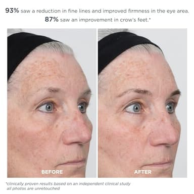 m-61 ProSmooth Retinol Eye Serum | 0.1% Non-Irritating Retinol Eye Serum with Vitamin C, 0.5 Fl Oz - Image 3